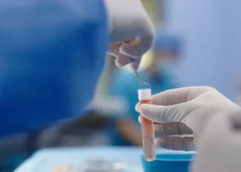 Abu Dhabi Stem Cells Center Conducts Innovative Surgical Procedures