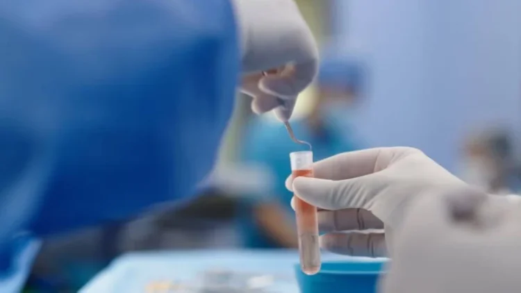 Abu Dhabi Stem Cells Center Conducts Innovative Surgical Procedures